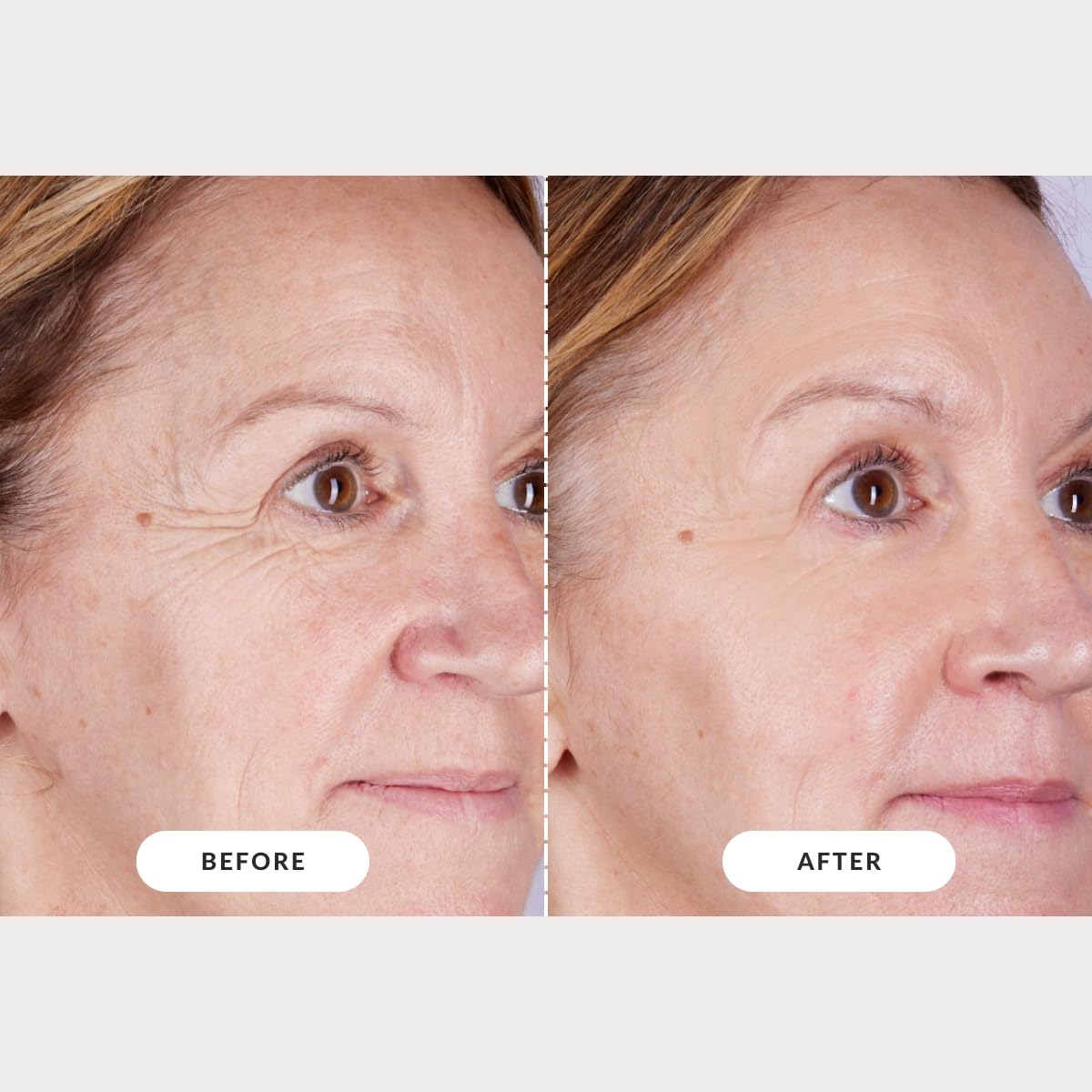 CurrentBody Red Light Therapy LED Face Mask: Series 2 Advanced Anti-Aging, Reduce wrinkles, Best-fit coverage, All skin types, Cordless, Auto shut-off, 10-min session, Storage bag