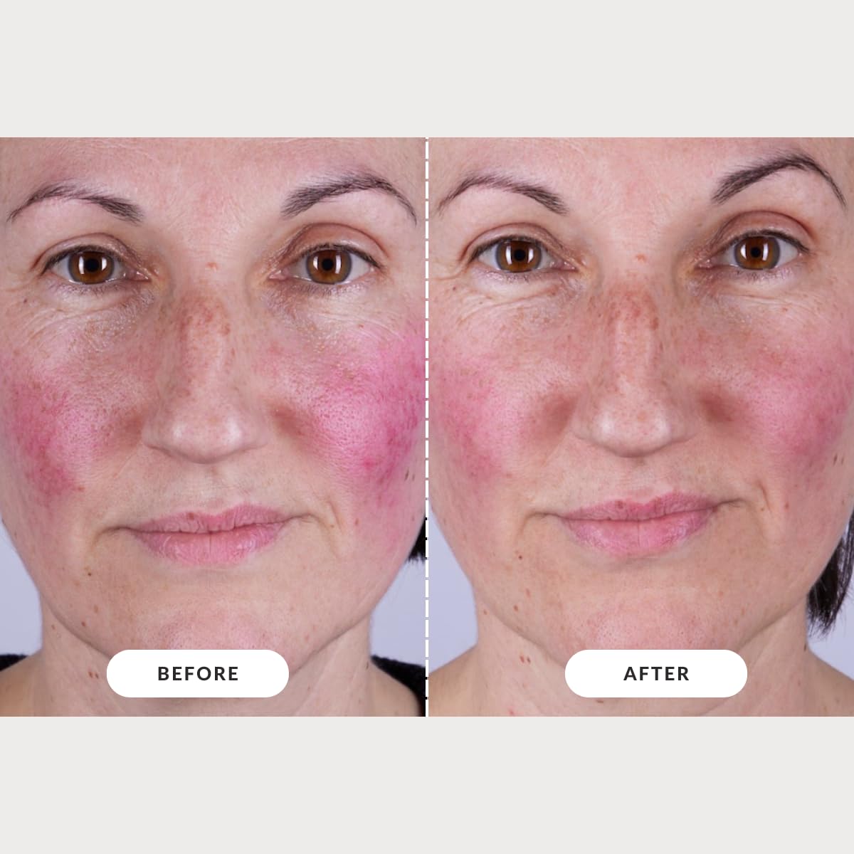 CurrentBody Red Light Therapy LED Face Mask: Series 2 Advanced Anti-Aging, Reduce wrinkles, Best-fit coverage, All skin types, Cordless, Auto shut-off, 10-min session, Storage bag