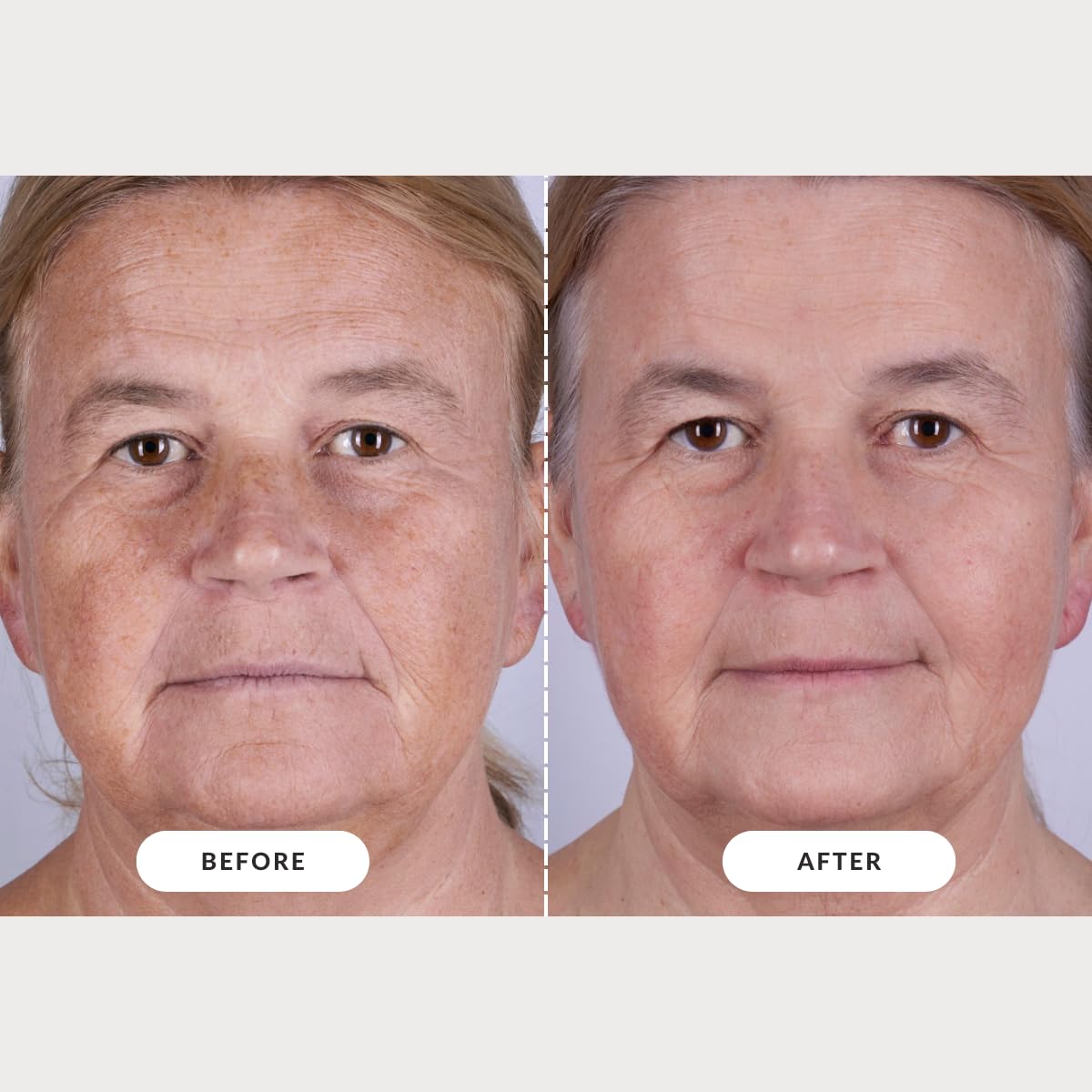 CurrentBody Red Light Therapy LED Face Mask: Series 2 Advanced Anti-Aging, Reduce wrinkles, Best-fit coverage, All skin types, Cordless, Auto shut-off, 10-min session, Storage bag